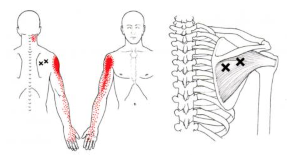 Trapezius Trigger Point Massager Release Pressure Upper-Back Waist  Acupressure